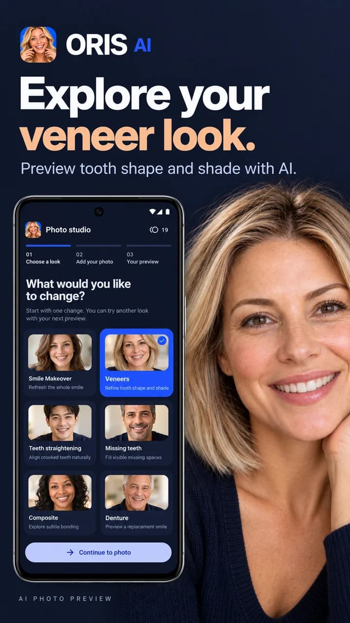 AI preview of veneer shape and shade