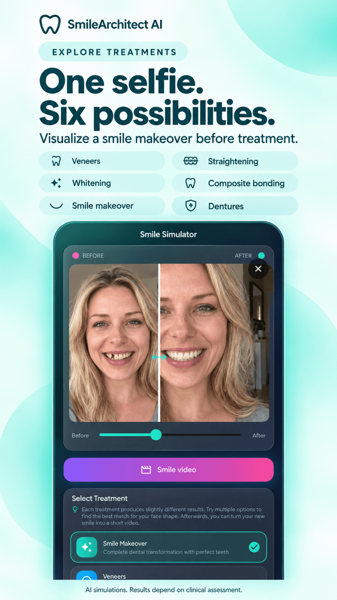 Smile Architect AI dental simulation app