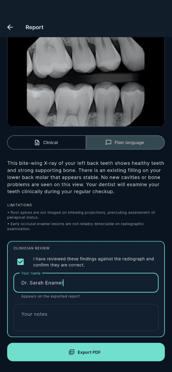 Chart-ready clinical note in XrayDent AI