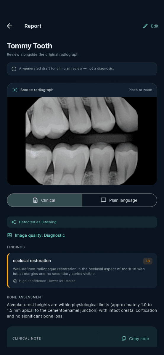 Language selector with over 100 clinical languages